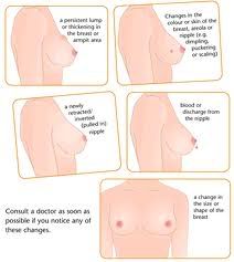 cancer treatment